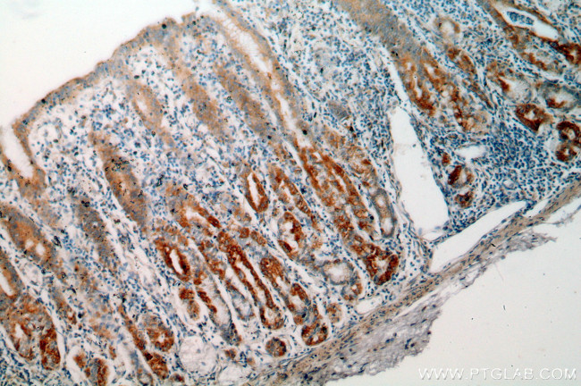 neuromedin B Antibody in Immunohistochemistry (Paraffin) (IHC (P))