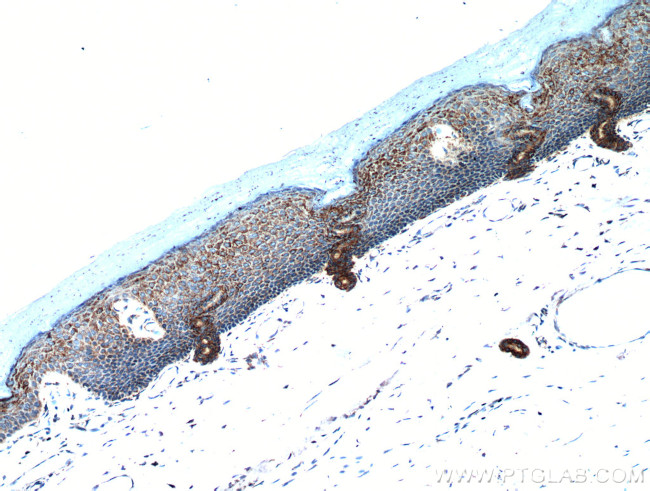 neuromedin B Antibody in Immunohistochemistry (Paraffin) (IHC (P))