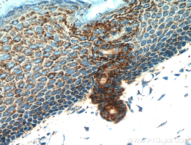 neuromedin B Antibody in Immunohistochemistry (Paraffin) (IHC (P))