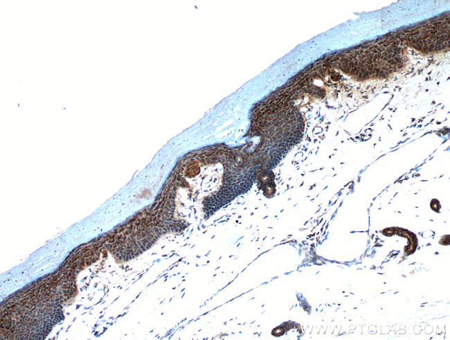 neuromedin B Antibody in Immunohistochemistry (Paraffin) (IHC (P))