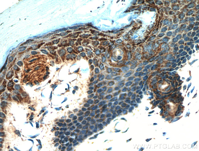 neuromedin B Antibody in Immunohistochemistry (Paraffin) (IHC (P))