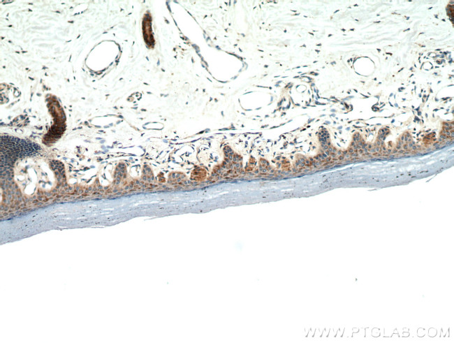 neuromedin B Antibody in Immunohistochemistry (Paraffin) (IHC (P))