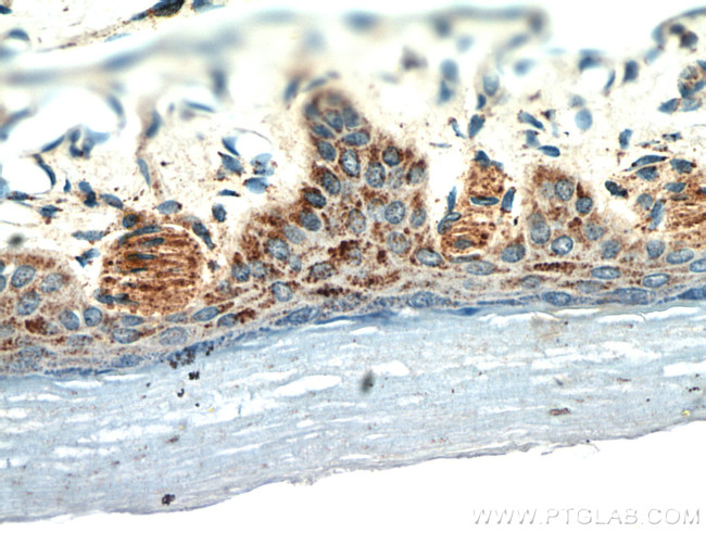 neuromedin B Antibody in Immunohistochemistry (Paraffin) (IHC (P))