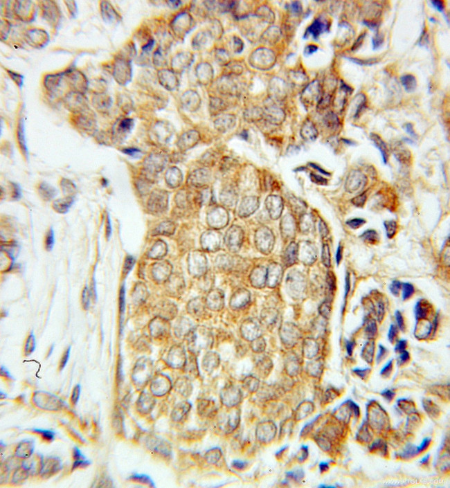 neuromedin B Antibody in Immunohistochemistry (Paraffin) (IHC (P))