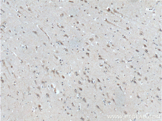 neuromedin B Antibody in Immunohistochemistry (Paraffin) (IHC (P))