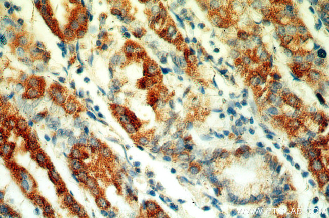 neuromedin B Antibody in Immunohistochemistry (Paraffin) (IHC (P))