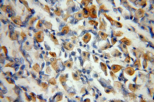 neuromedin B Antibody in Immunohistochemistry (Paraffin) (IHC (P))