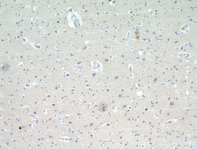 neuromedin B Antibody in Immunohistochemistry (Paraffin) (IHC (P))