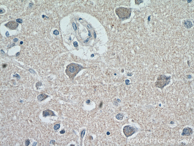 neuromedin B Antibody in Immunohistochemistry (Paraffin) (IHC (P))