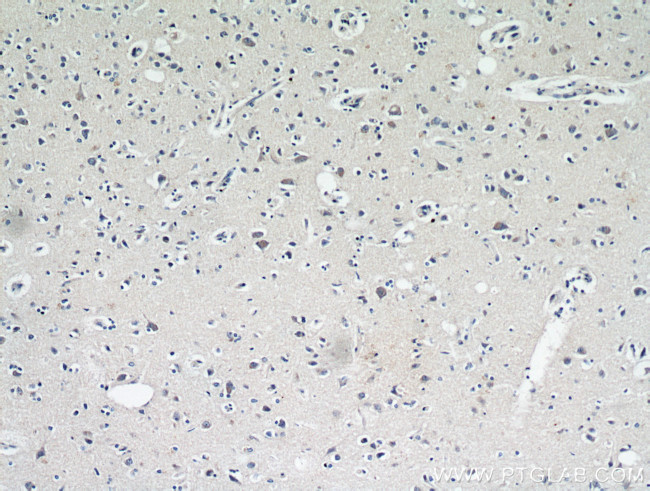 neuromedin B Antibody in Immunohistochemistry (Paraffin) (IHC (P))