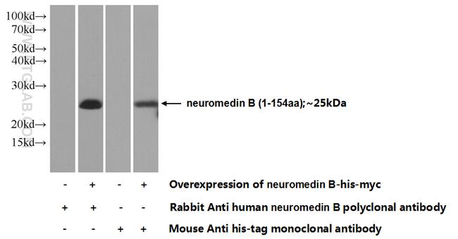 neuromedin B Antibody in Western Blot (WB)