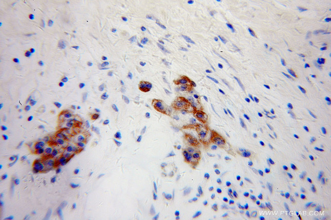 NPTX2 Antibody in Immunohistochemistry (Paraffin) (IHC (P))