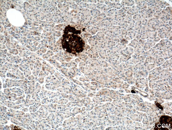 NPTX2 Antibody in Immunohistochemistry (Paraffin) (IHC (P))