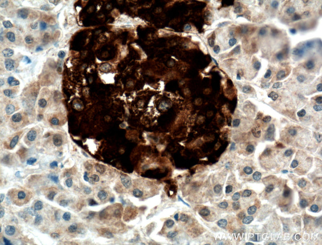 NPTX2 Antibody in Immunohistochemistry (Paraffin) (IHC (P))