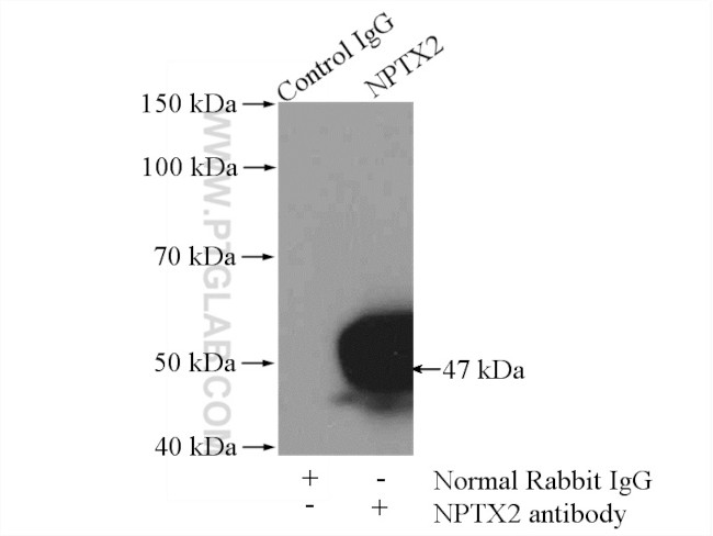 NPTX2 Antibody in Immunoprecipitation (IP)