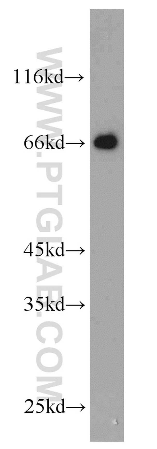 NPTX2 Antibody in Western Blot (WB)