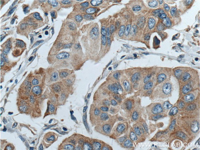 PLDN Antibody in Immunohistochemistry (Paraffin) (IHC (P))