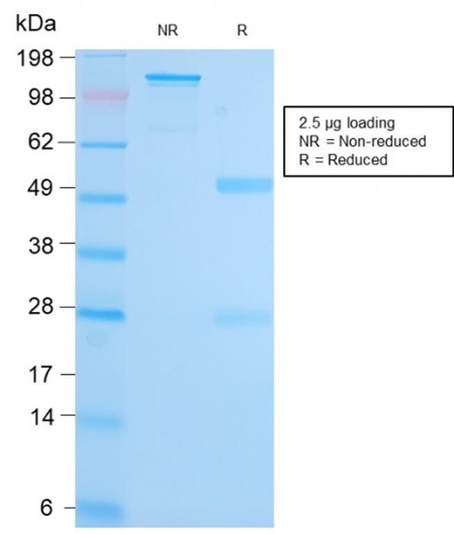 MALT1 Antibody in SDS-PAGE (SDS-PAGE)