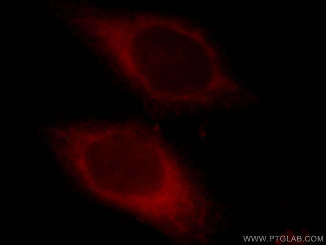 CYB5R3 Antibody in Immunocytochemistry (ICC/IF)