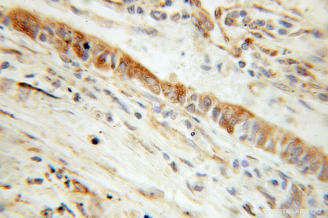 CYB5R3 Antibody in Immunohistochemistry (Paraffin) (IHC (P))