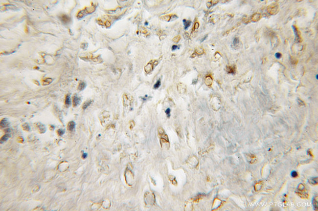 CYB5R3 Antibody in Immunohistochemistry (Paraffin) (IHC (P))