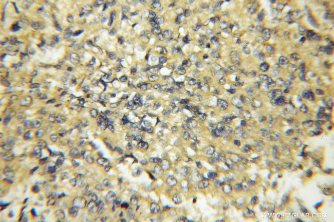 CYB5R3 Antibody in Immunohistochemistry (Paraffin) (IHC (P))