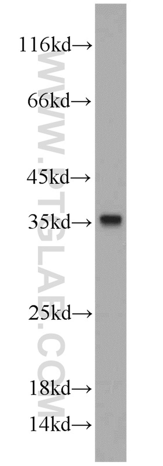 CYB5R3 Antibody in Western Blot (WB)