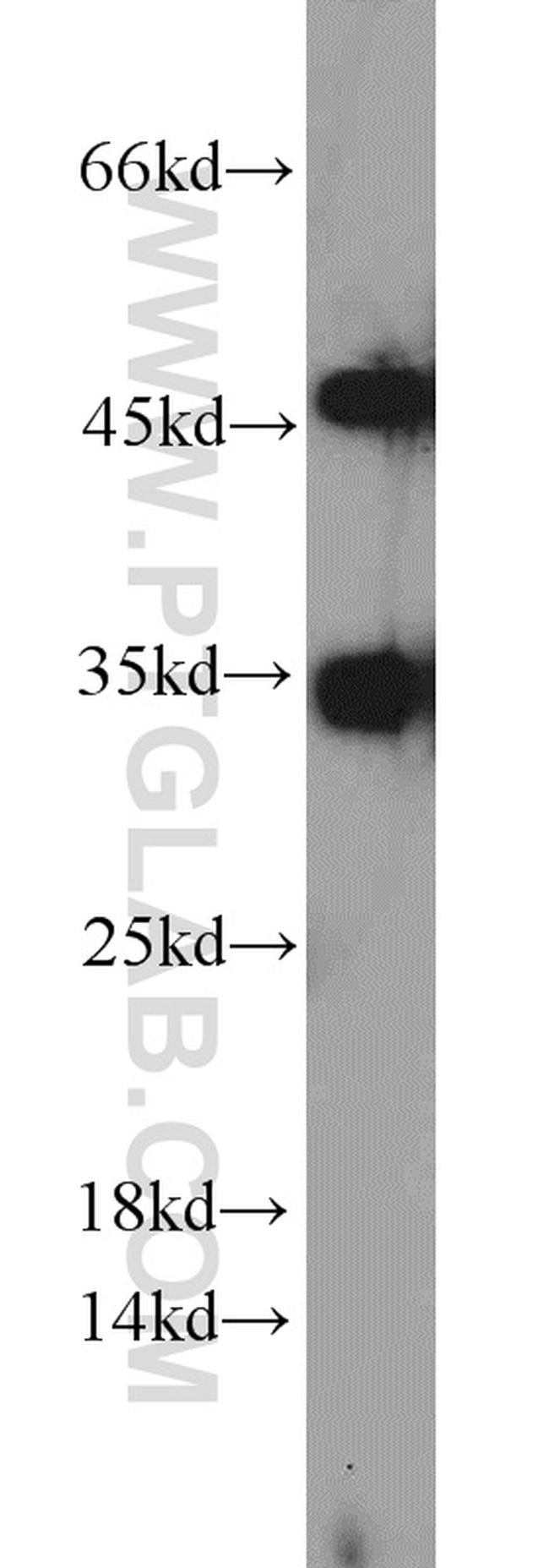 CYB5R3 Antibody in Western Blot (WB)