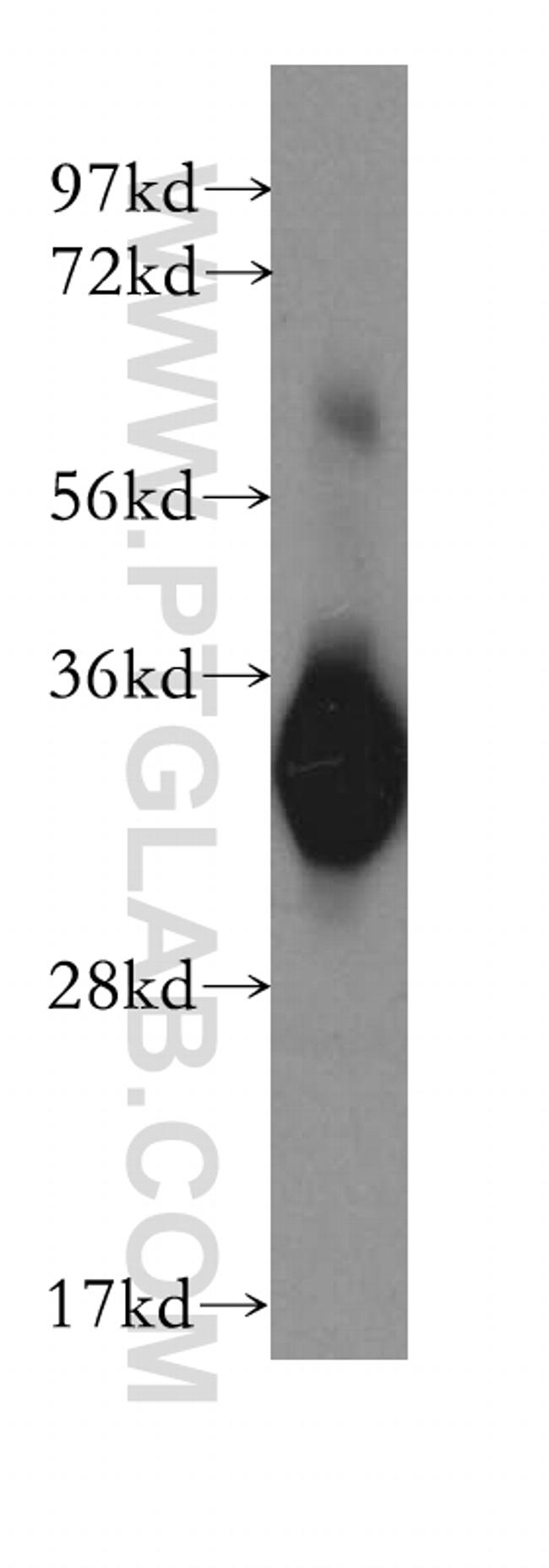 CYB5R3 Antibody in Western Blot (WB)