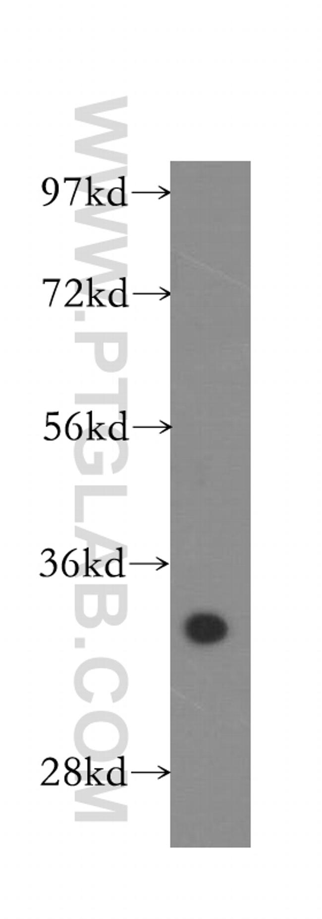 CYB5R3 Antibody in Western Blot (WB)