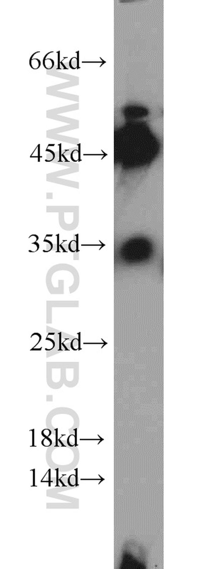 CYB5R3 Antibody in Western Blot (WB)