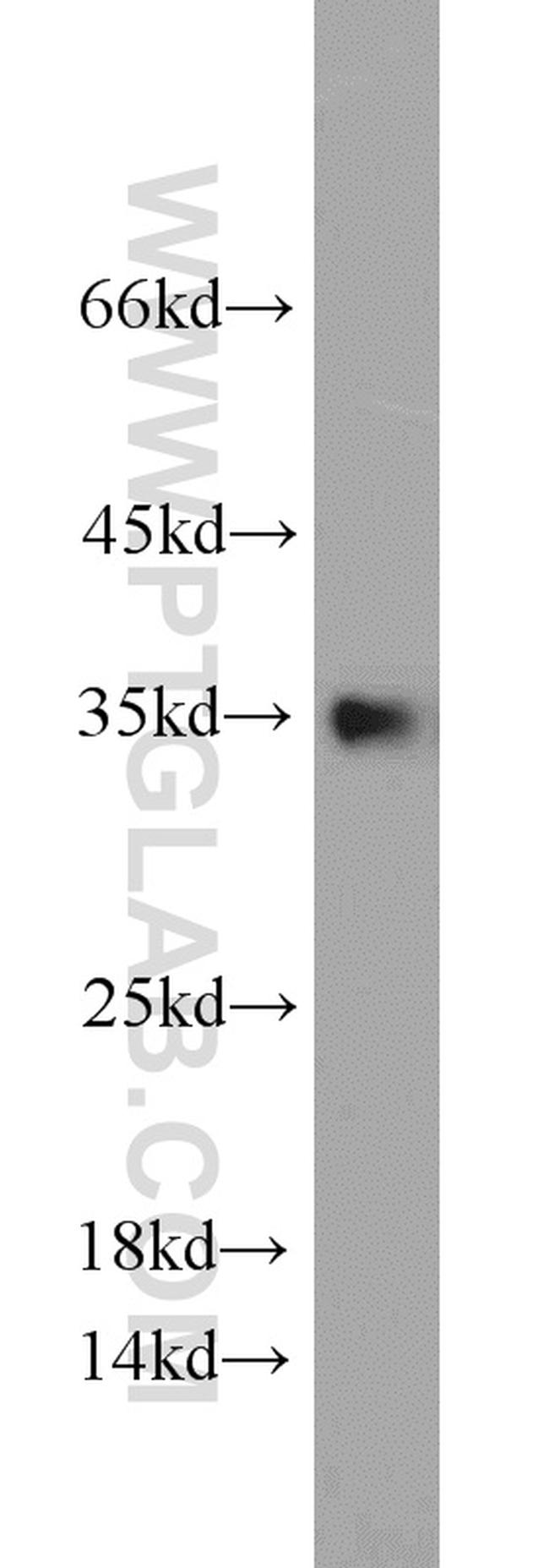 CYB5R3 Antibody in Western Blot (WB)