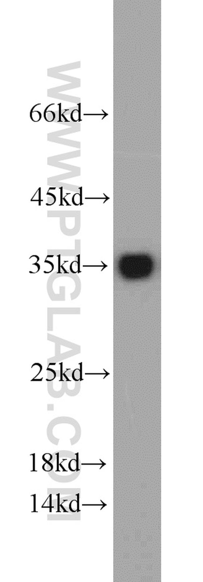 CYB5R3 Antibody in Western Blot (WB)