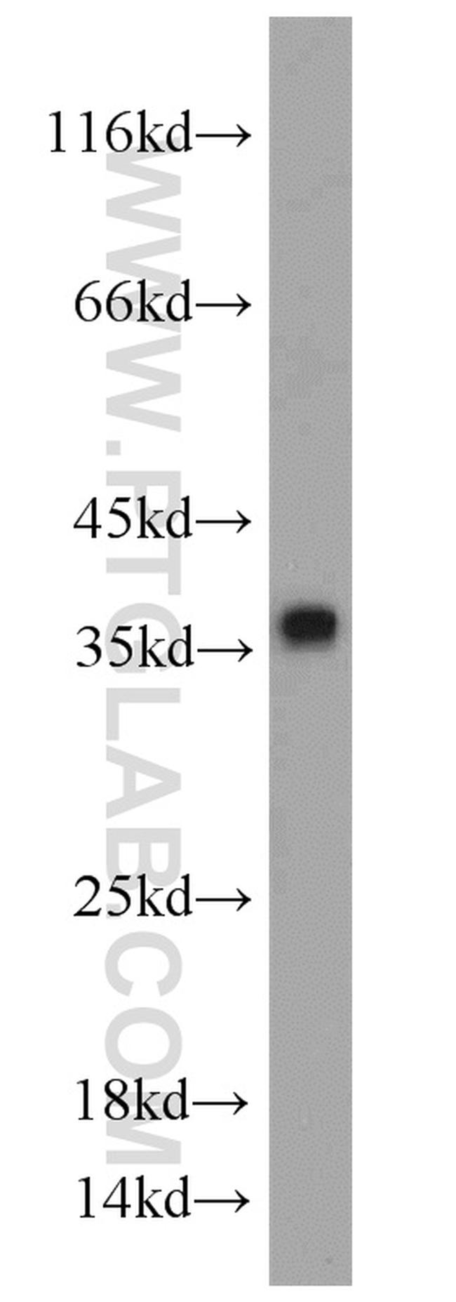 CYB5R3 Antibody in Western Blot (WB)