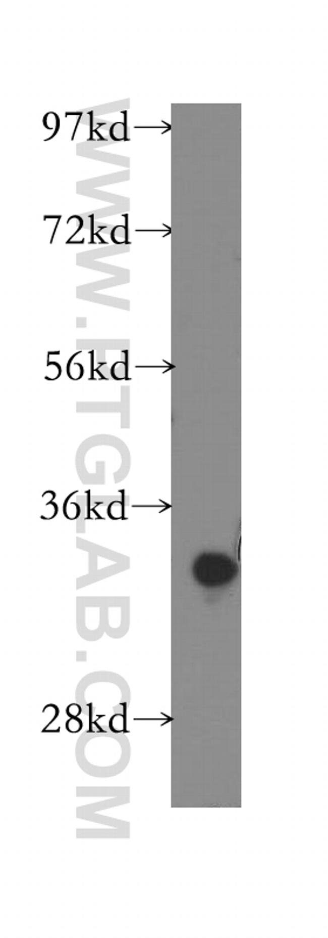 CYB5R3 Antibody in Western Blot (WB)