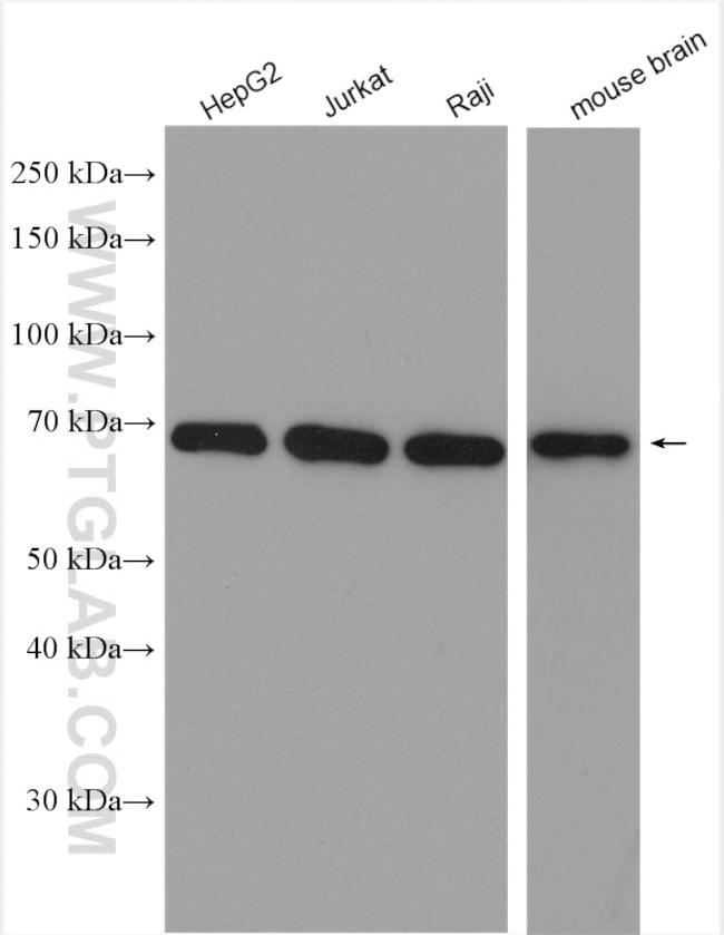 LMNB2 Antibody in Western Blot (WB)