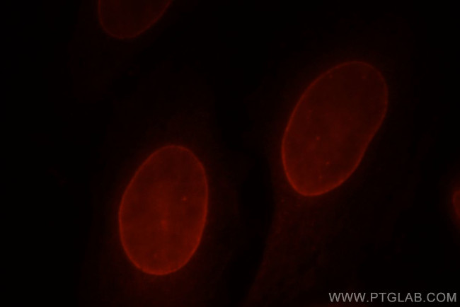 LMNB2 Antibody in Immunocytochemistry (ICC/IF)