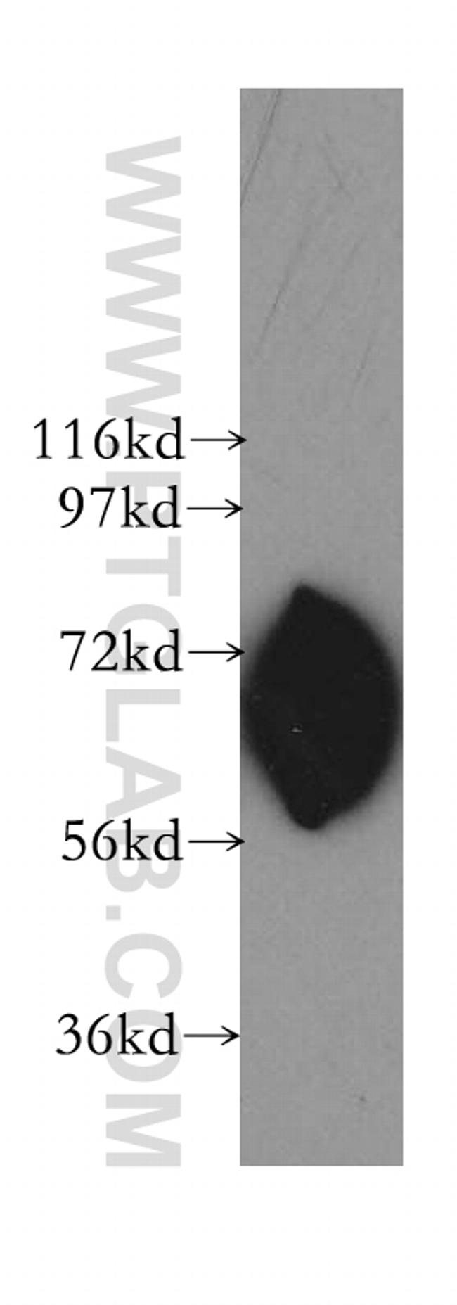 LMNB2 Antibody in Western Blot (WB)