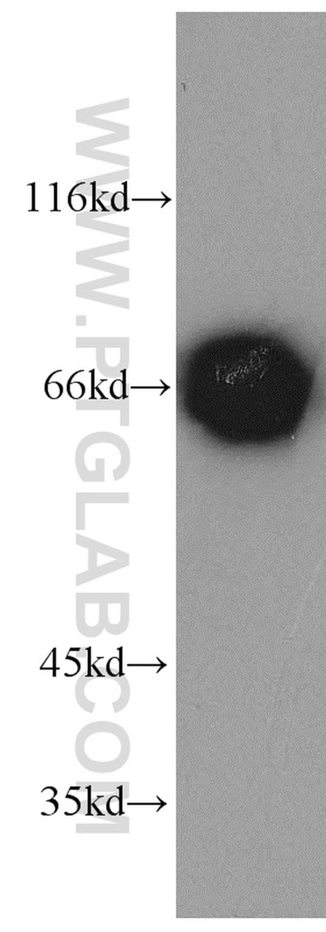 LMNB2 Antibody in Western Blot (WB)