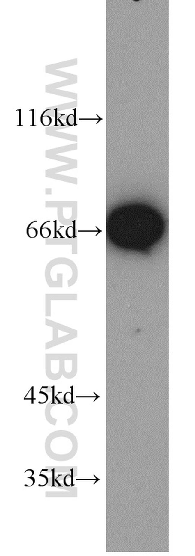 LMNB2 Antibody in Western Blot (WB)