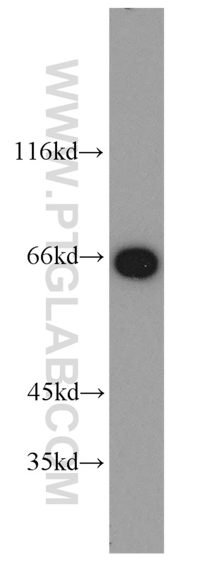 LMNB2 Antibody in Western Blot (WB)