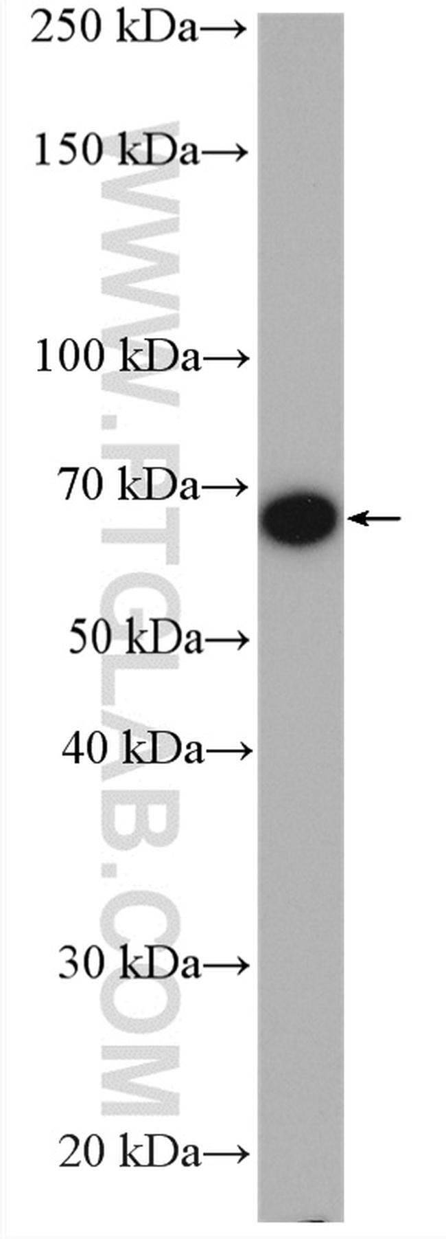 LMNB2 Antibody in Western Blot (WB)