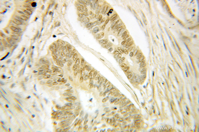 LMNB2 Antibody in Immunohistochemistry (Paraffin) (IHC (P))