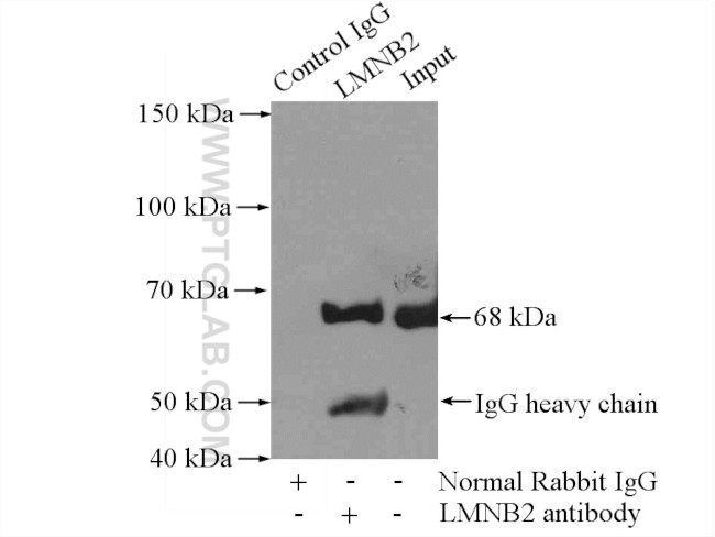 LMNB2 Antibody in Immunoprecipitation (IP)