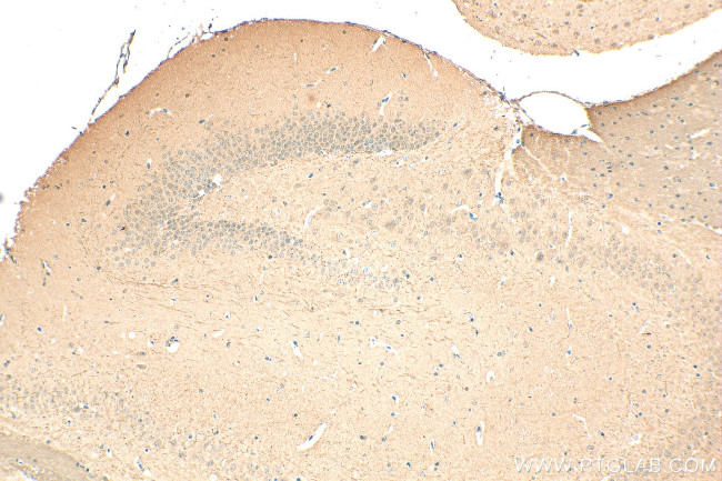 ING4 Antibody in Immunohistochemistry (Paraffin) (IHC (P))