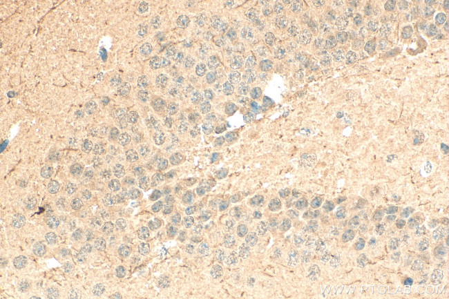 ING4 Antibody in Immunohistochemistry (Paraffin) (IHC (P))