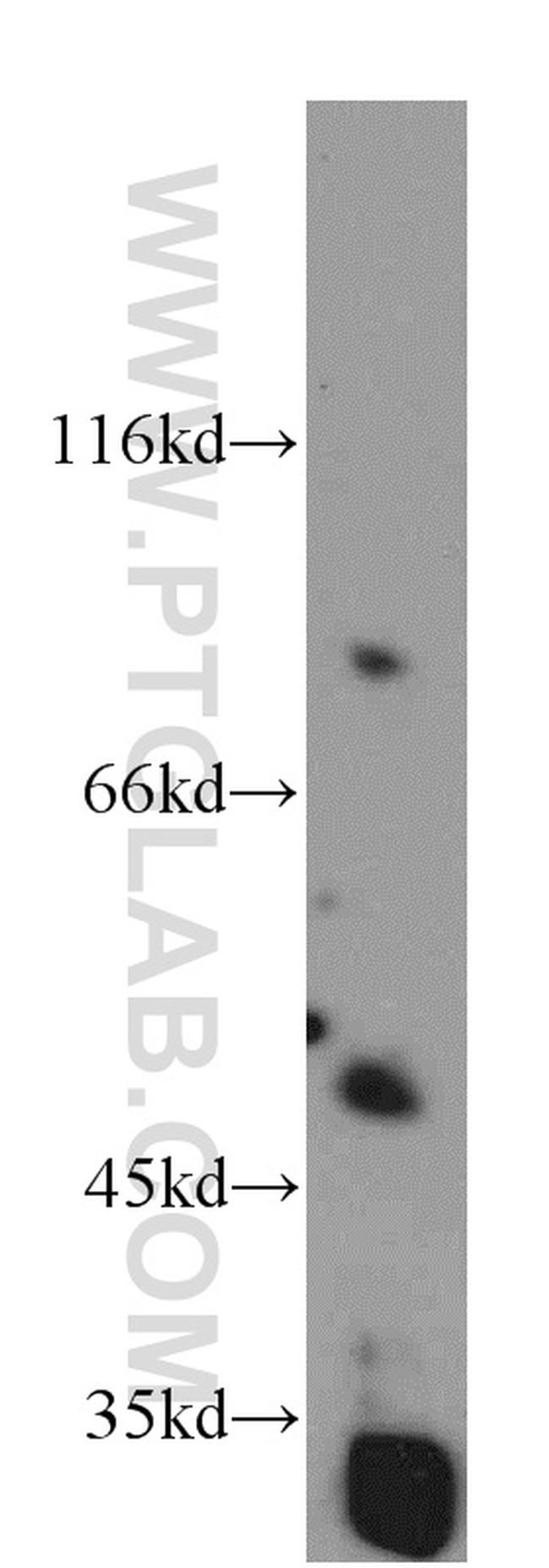 EIF3E Antibody in Western Blot (WB)