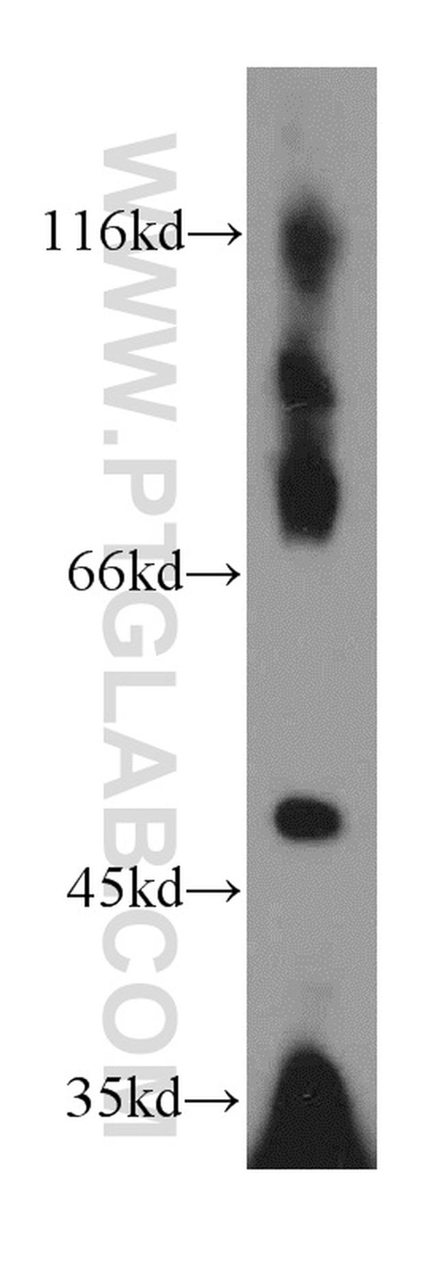 EIF3E Antibody in Western Blot (WB)