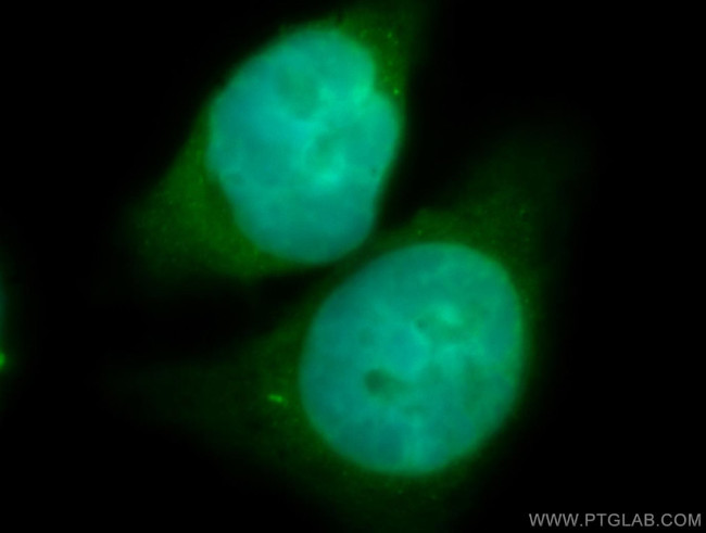 EIF3E Antibody in Immunocytochemistry (ICC/IF)