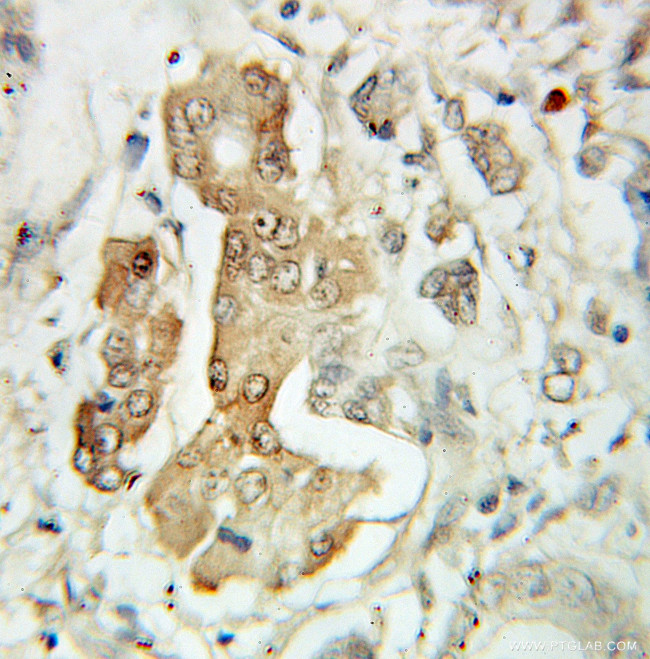 EIF3E Antibody in Immunohistochemistry (Paraffin) (IHC (P))